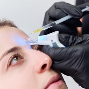Toxina Botulínica o Botox para la cara - Dermatología, cuidado de la piel