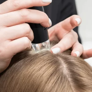 Diagnóstico Capilar